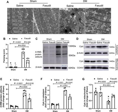 A ROCK1 Inhibitior Fasudil Alleviates Cardiomyocyte Apoptosis in Diabetic Cardiomyopathy by Inhibiting Mitochondrial Fission in a Type 2 Diabetes Mouse Model